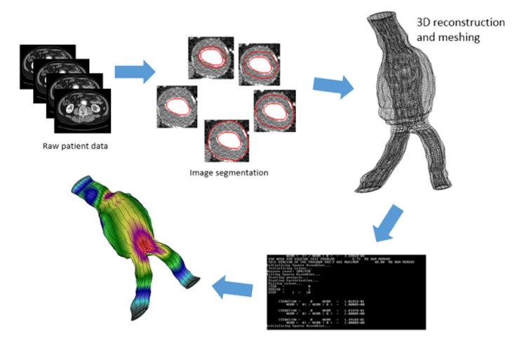 3D reconstruction