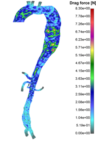 CFD simulation