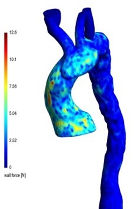 Systemic pressure